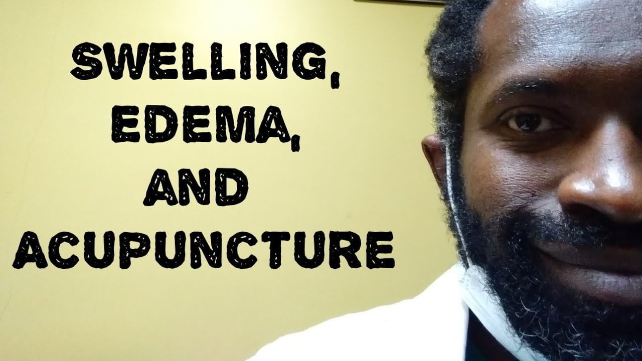 A picture Carlo St Juste, acupuncturist, martial arts and Tai chi instructor, and the words "Swelling, Edema, and Acupuncture"