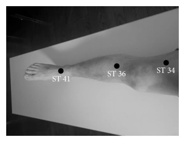 stomach 34 acupoint location st34