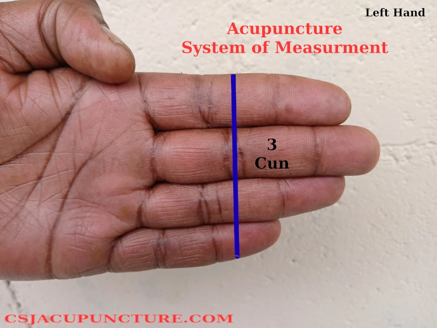 3 cun acupuncture example