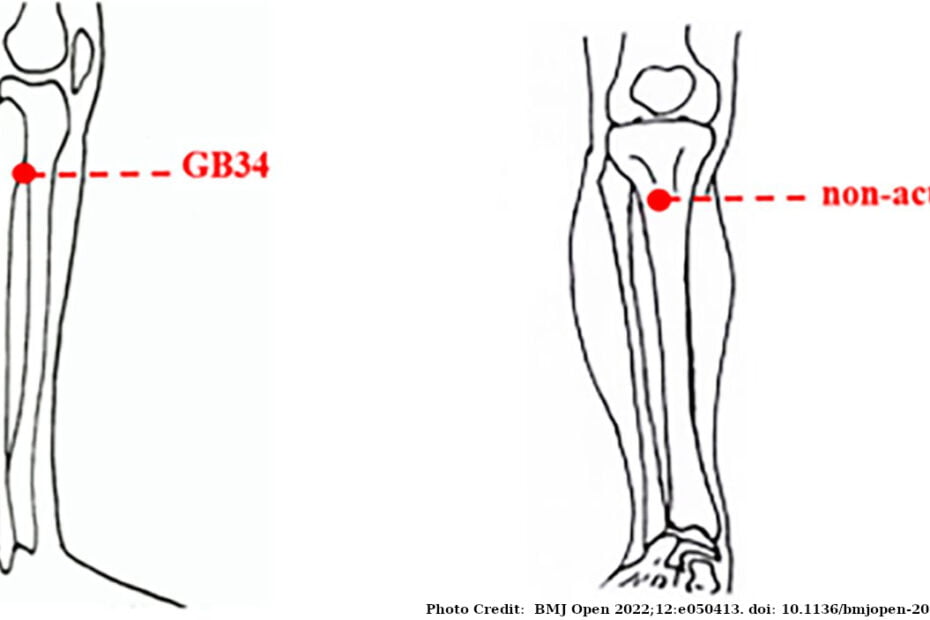 gb 34 acupuncture point location
