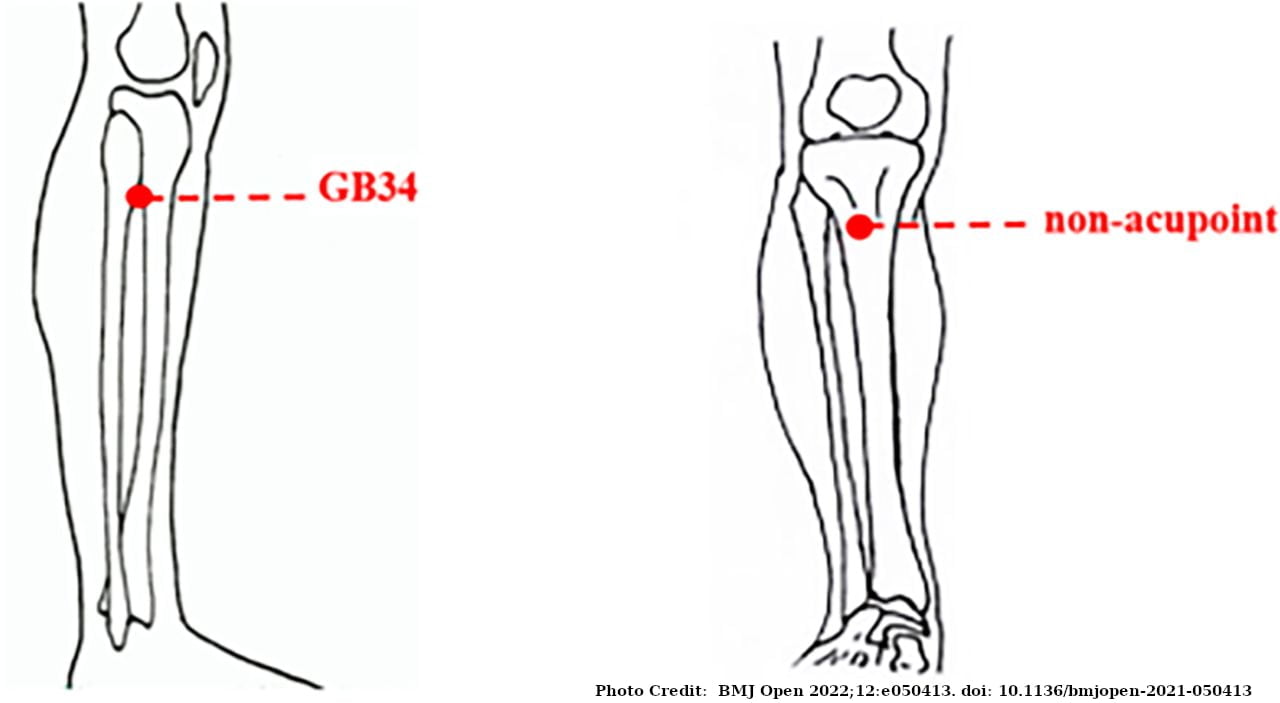 gb 34 acupuncture point location