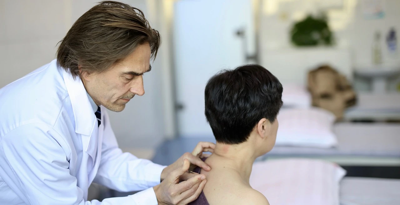 Acupuncture on the back