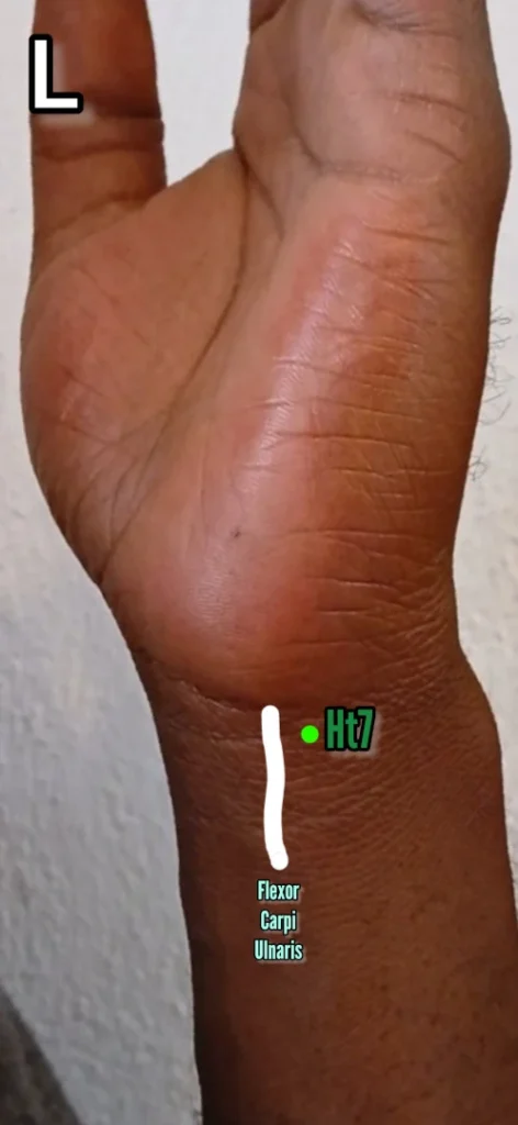 heart 7 acupuncture point technique