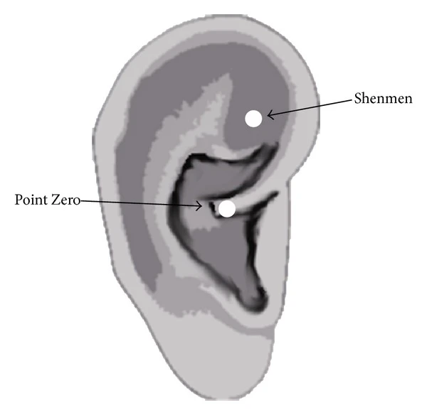 shenmen ear auricular acupuncture point location