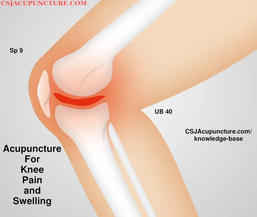 acupuncture for swollen knee