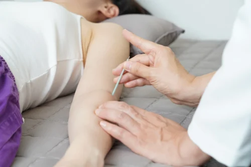 Do Acupuncture Needles Hurt